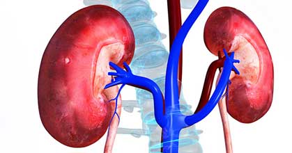 masalah ginjal akibat dehidrasi